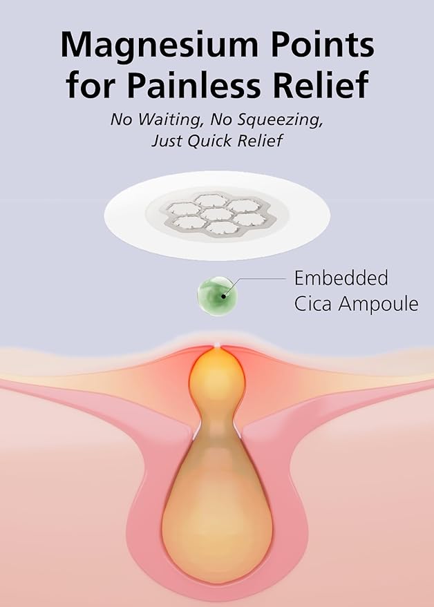 Quick Calming Magnesium Patches(20 patches) with Cica Ampoule - Intensive Care, Pimple patches, Hydrocolloid Band, Zits Spot care Overnight Home Care 2-8 hours, New boxs types