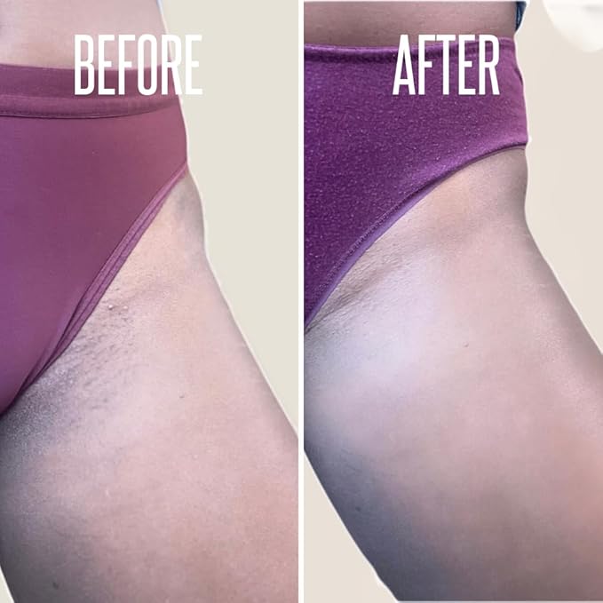 Save 14% on The Skin Care Solution For Dark Spots, Razor Bumps, Ingrown Hair & Razor Burns – Includes Our Ultra Potent Brightening + Razor Bumps Solution For an Ultra Clear & Glowing Skin