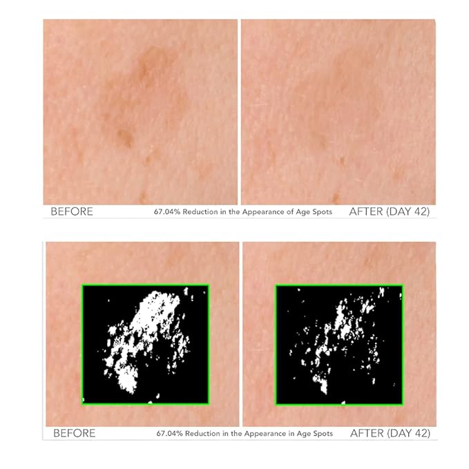 Serious Skincare - Beyond Intensive Vitamin C Serum for Face & Neck - 60 Day Facial Treatment to Brighten & Revive Glow - Visibly Smooth Lines, Wrinkles and Pores - AM & PM 2 Piece Skin Care Set