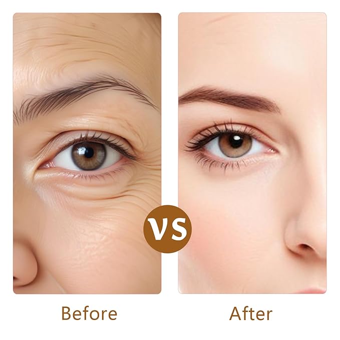 Forehead Wrinkle Patches, 16 Pcs Reusable Silicone Anti Wrinkle Patches Facial Patches for Face to Reduce Fine Wrinkles Frown Smile Lines Forehead Wrinkles Treatment