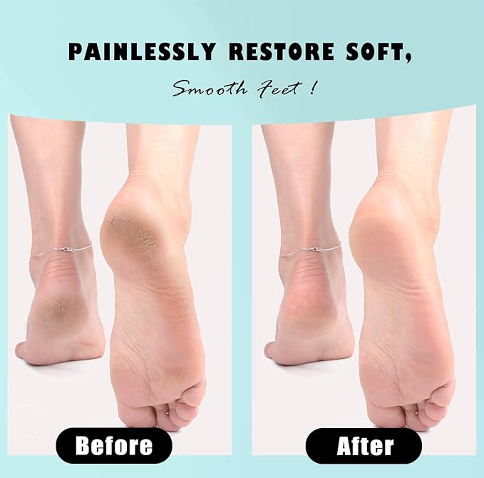 Glass Foot File Callus Dead Remover Heel Scraper and Shower Scrubber - Safely and painlessly removes calluses and Dry Skin from Heels (Blue)