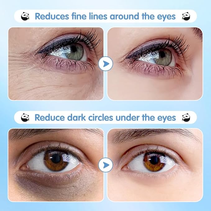 Hydrating Under Eye Patches for Dark Circles & Puffy Eyes - 60 Pairs Eye Mask with Hyaluronic Acid, Blueberry & Centella - Vegan, Cruelty-Free Skincare