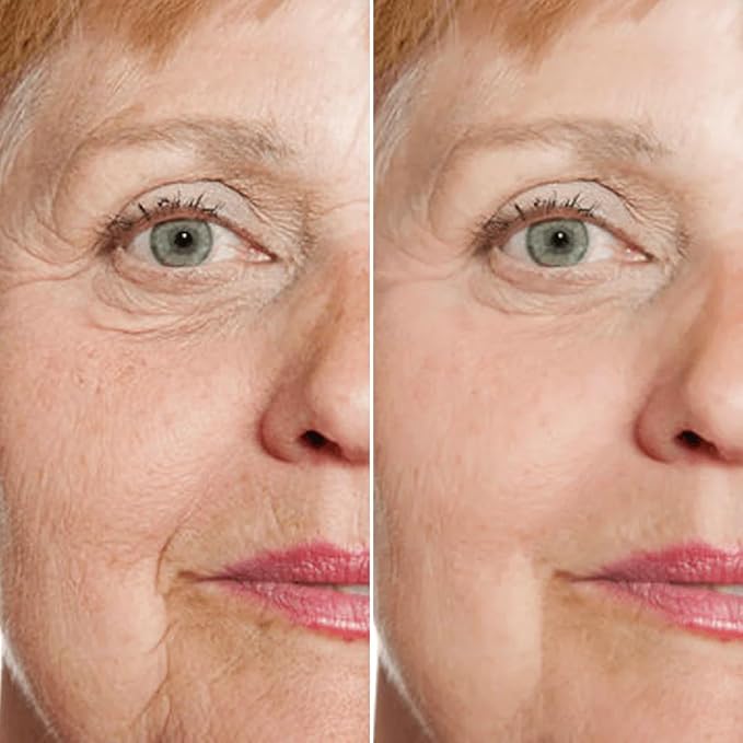 Rejuvenate Face Serum（3pcs），Stock Solution Facial Serum, in a Bottle, Instant Face Lift & Anti Aging Serum for Reduce Wrinkles - Fine Lines-plumping Skin，Hyaluronic Acid Formula for All Skin Types