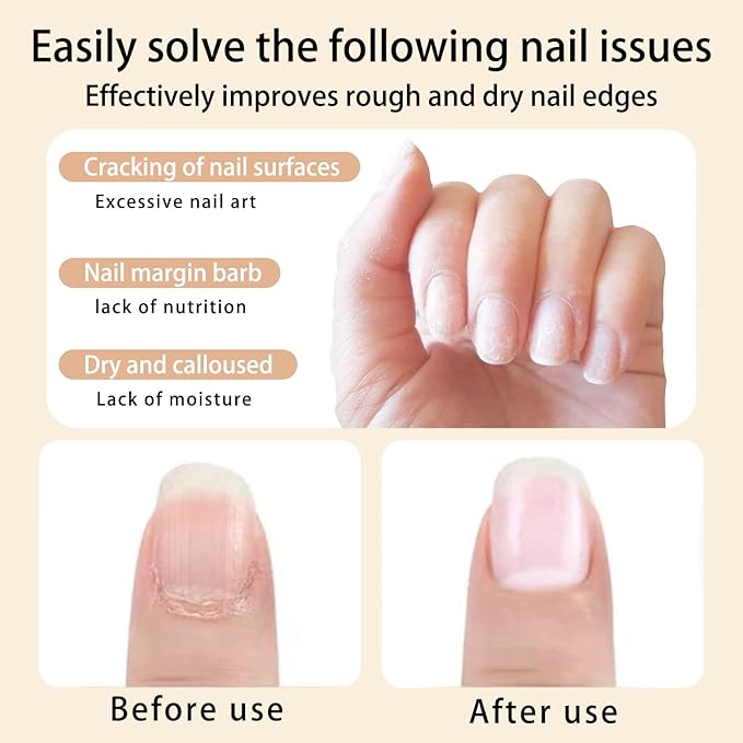 Cuticle Oil KIT 2 Scent (Rose Cherry) Revitalize and Strengthen Your Nails Premium Nail Nutrient Oils Ideal for Home DIY or Nail Salon