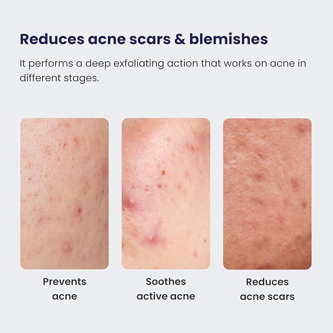 RE' EQUIL 0.5% Retinol Night Cream Makes Skin Youthful Smooth Prevents Fine Lines Wrinkles Unisex All Skin Types 30G