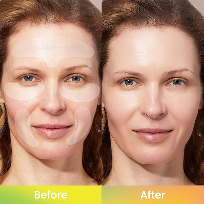 evpct 10Pcs Reusable Silicone Face Tape Wrinkle Patches for Forehead Under Eye and Smile Fine Lines, Face Tape for Castor Oil Facial Tape Smoothing Forehead Wrinkle Patches for Face Wrinkles Overnight