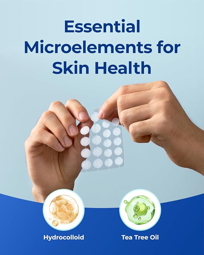 Pimple Patches for Face Acne: Invisible 0.1mm Ultra-Thin Hydrocolloid Zit Stickers with Tea Tree Oil - 308 Dots, 2 Sizes (Whiteheads/Sensitive Skin)