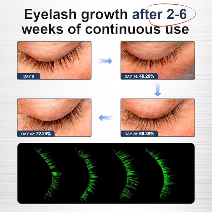 VGO Eyelash Serum - Lash Serum for Eyelash Growth, Clear Effect for Thicker, Longer Lashes with Natural Ingredients - Safe, Gentle & Non-Irritating for All Skin Types.