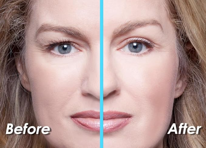 Premium Eyelid Lift (L/XL Kit + Gel) Made in the USA. Lifts and Defines Droopy, Sagging or Hooded Eyes Safe for Daily Use