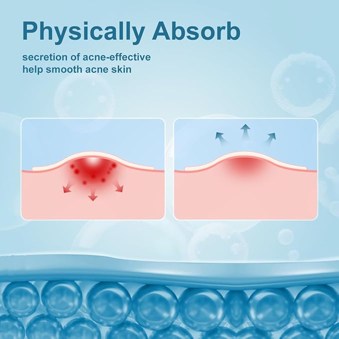 Pimple Patches for Face, Hydrocolloid Acne Patches, Absorb Zits and Blemishes, Invisible Spot Cover, Treatment for Breakouts, Acne Stickers with Salicylic Acid and Tea Tree Oil (36 Count)