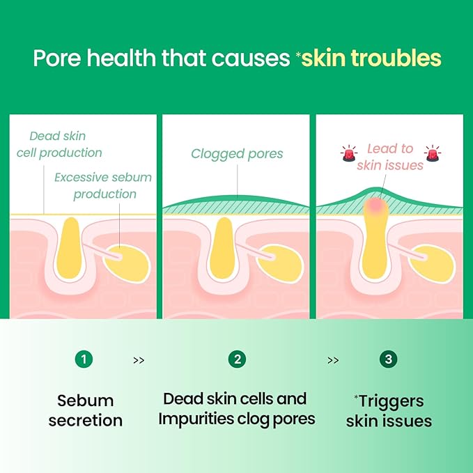 ilso No Problem Spot Patch, 72 Patches in 3 Sizes, Hydrocolloid Acne & Pimples Patches with Hyaluronic Acid and Niacinamide to reduce acne, White dots absorbed, Korean Skincare