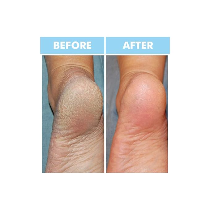 Bodipure Premium Foot Mask Keratin Socks | at Home Spa Moisturizer Socks for Dry Cracked Feet, Callus & Heel Softening | Easy-to-Use Pedicure Foot Repair | Chemical-Free Feet Treatment | 100 Pairs