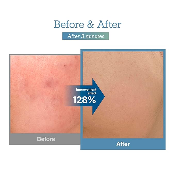 Bluelayer Water Dome Mask & Blue Centella Calming Cream - Blue Hydrogel Overnight Mask and Calming Face Moisturizer for Hydrating - Firming, Moisturizing, and Pore Minimizing for Radiant Glow