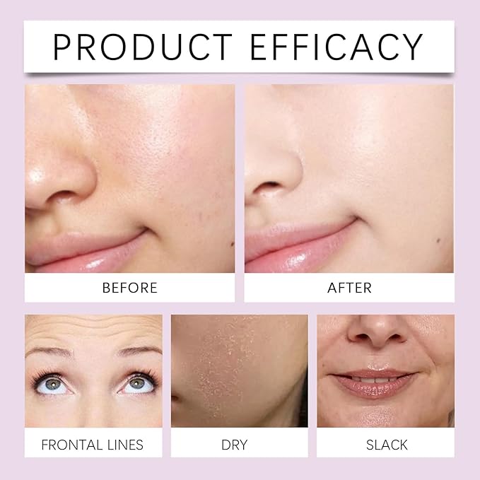 Forehead Wrinkle Patches and Smile Line Patches Set,Overnight Collagen Facial Wrinkles Patches to Lift Smile Lines for Women Anti-wrinkles Face Patches 12prs