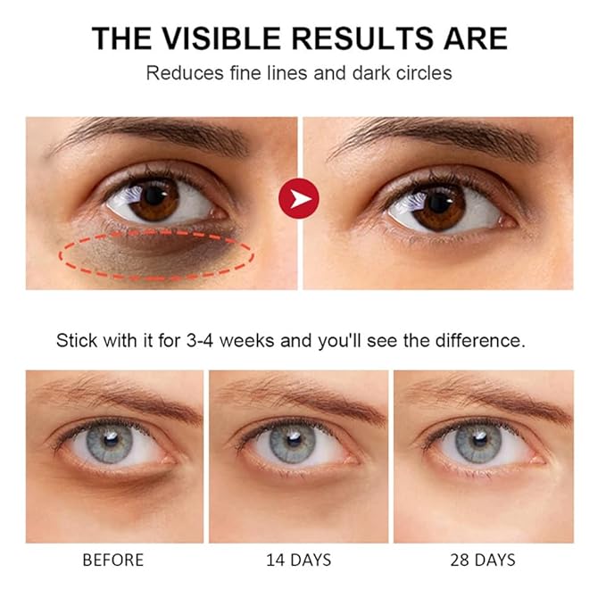 Retinol Eye Stick, Retinol Eye Cream With Collagen,Hyaluronic Acid For Dark Circle, Wrinkles, Under Eye Cream Anti Aging, Retinol Eye Balm Reduces Puffiness Fine Lines, Visible Results in 3-4 Weeks