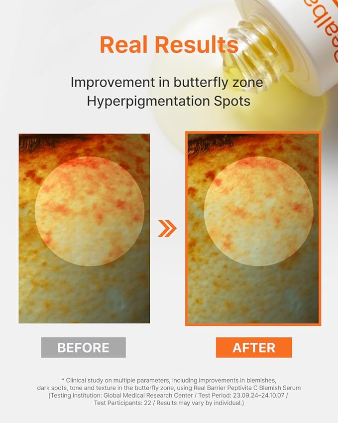 Real Barrier | Peptivita C Blemish Serum | Face Serum for Uneven Skin Tone & Smooth Texture | Vitamin C Face Care for Sensitive Skin | Facial Skin Care Products | Korean Skincare | 1.01 fl oz (30ml)