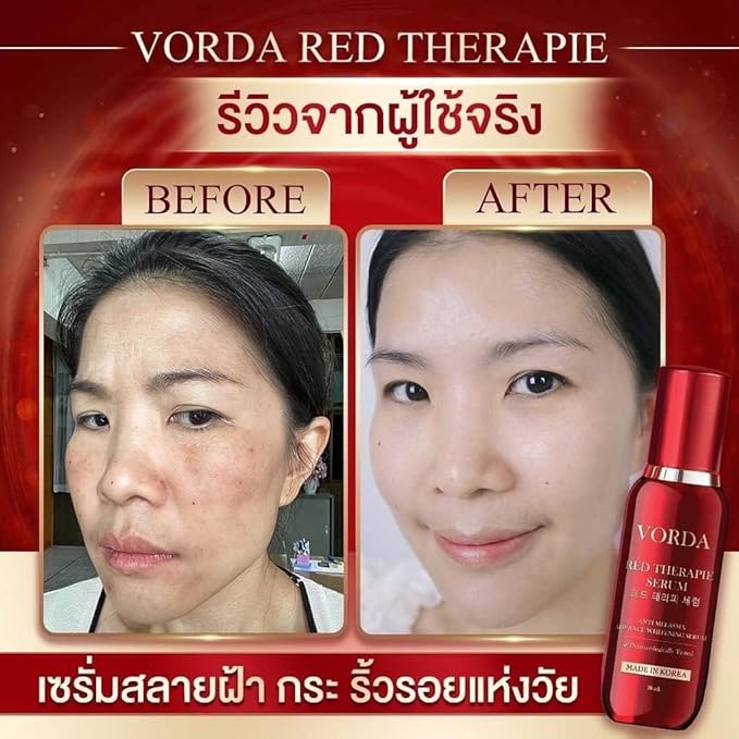 Vorda Red Therapie Serum Facial 30ml Made In Korea X50 Photoglow