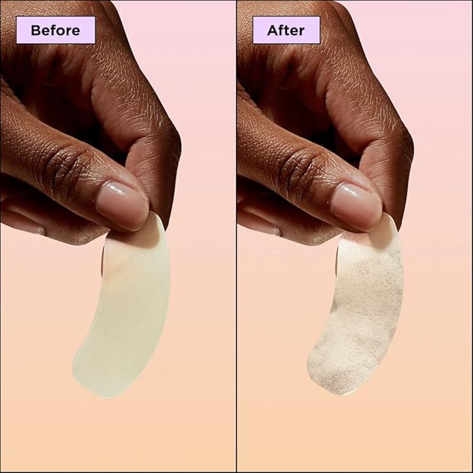 ZitSticka Hydrocolloid Surface Area Pimple Patches for Face - Clarifying Pore & Blemish for Large Zit T-Zone Coverage - Zit Sticker Absorbs Oil, Unclogs Pores, & Targets Clusters (FACE MAP 2PC)