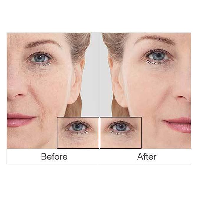 DermaSet Instant Face and Eye Lift | Face Skin Under Eye Tightening for Wrinkles, Lose Skin, Puffiness and Fine Lines | Fast Action Product within 5 Minutes | 0.51 Fl Oz (Pack of 1)