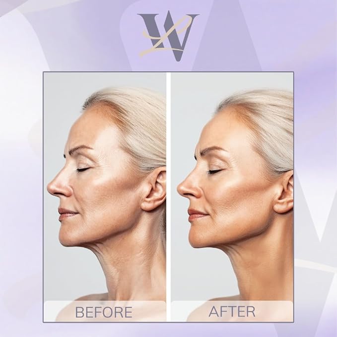 Reusable Neck Wrinkle Patches 10Pcs, Anti Wrinkle Patches, Face Tape for Wrinkles Overnight, Silicone Neck Patches, Silicone Wrinkle Patches for Neck Overnight, Silicone Patches for Wrinkles