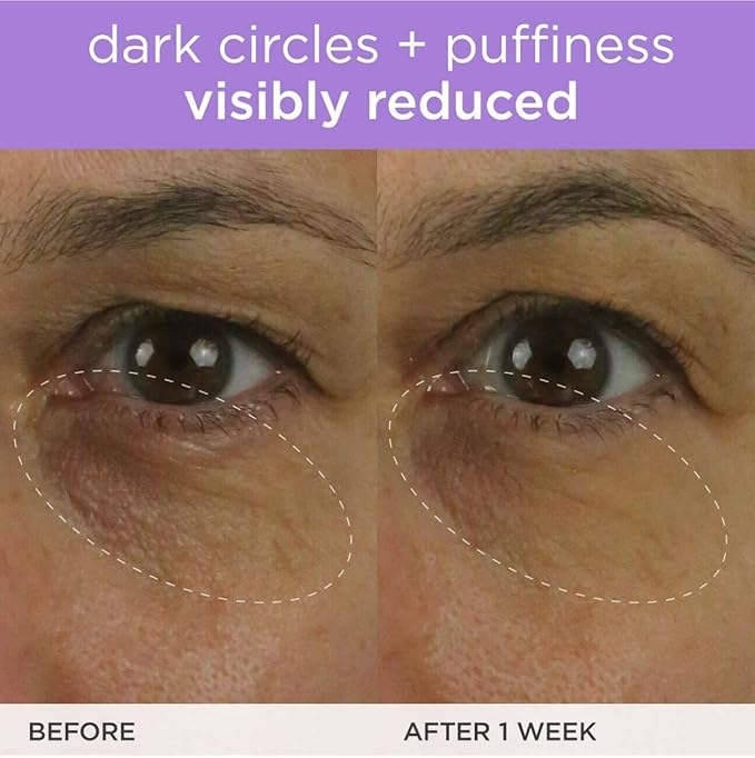 TATCHA The Brightening Eye Cream | Brightening & Dark Circle Reduction with Vitamin C for Bight, Firm Undereyes, 15 ml / 0.5 fl. oz.