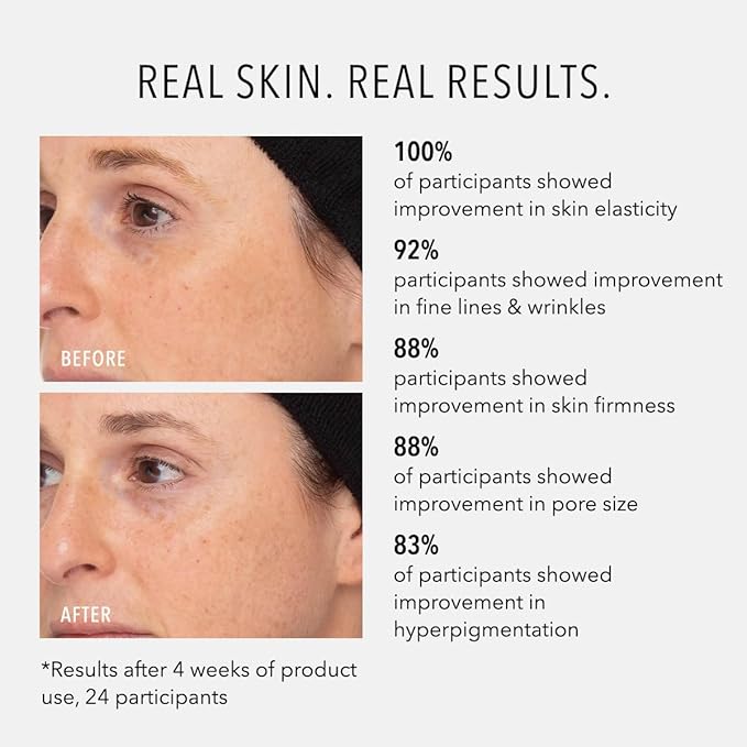 HydroPeptide Retinol Routine Booster, 1% Universal Tri-Retinol Complex Peptide Solution, 1 Ounce