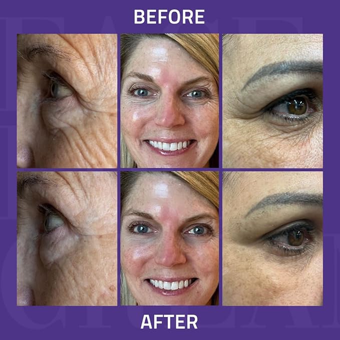 YEOUTH Instant Face Lift Cream, Temporary Skin Tightening Under Eye Cream for Women, Tightening and Lifting Concealer 15ml