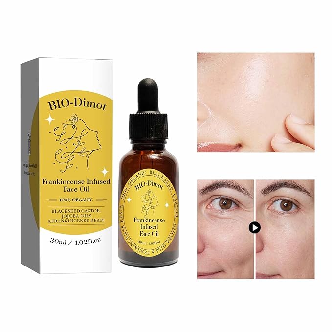 Frankincense Resin Oil, Natural Castor and Jojoba Oils Cold Pressed Serum Face Hydrates Anti-Aging Organic Frankincense Oil. -3Pcs