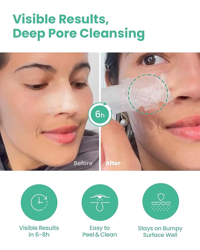 GLAM UP Spotless Nose Patch Hydrocolloid Coverage for Nose Pores, Zits and Oil - Overnight Strong Waterproof to Absorb Blackheads & Pimple Nose Gunk, and Calm with Tea Tree (12 Patches)