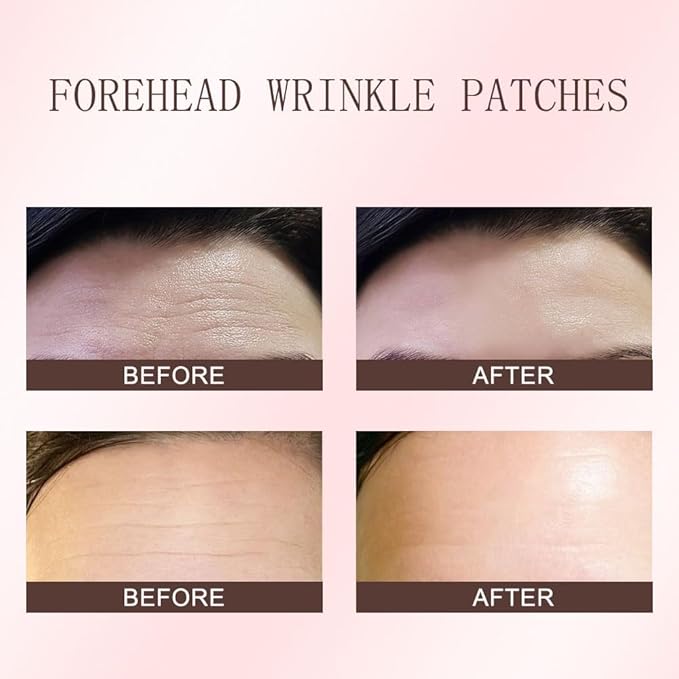 evpct 12Pcs Forehead Wrinkle Patches Face Tape Smoothing Facial Anti Wrinkle Patches for Face Wrinkles Overnight