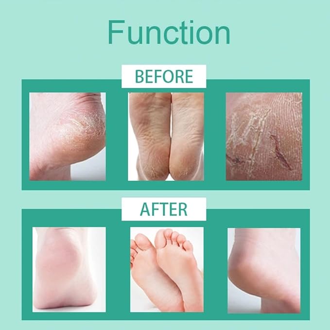 Exfoliating Foot Peel Mask for Dry, Cracked Heels - Moisturizing Foot Mask for Dead Skin & Callus Removal, Lavender Scent, 2 Pack - Foot Spa Treatment for Men & Women