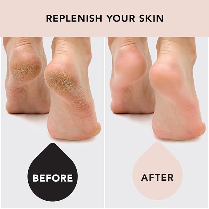 Kitsch Moisturizing Socks for Cracked Heel Treatment, Insulated Gel & Moisturizing Heel for Dry Cracked Feet Women & Men, Spa & Sleep Socks for Overnight Moisture Repair, 1 Reusable Pair