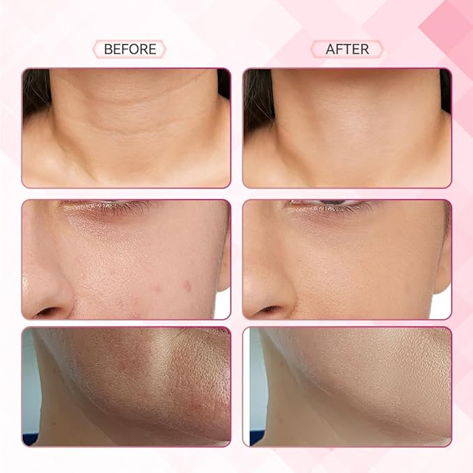 Face Neck Massager, 7-in-1 Face Sculpting Tool, Facial Massager for Skin Care, Face Massager with Vibration（White）