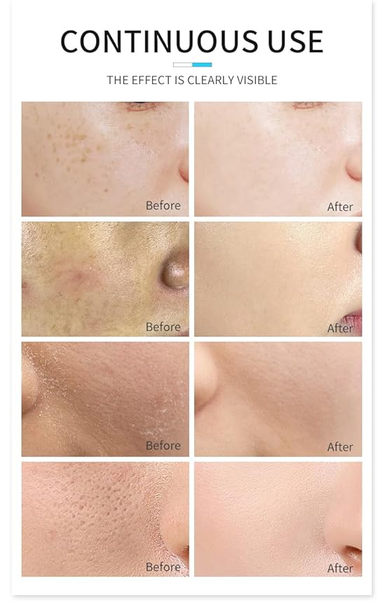 Ice Water Sleeping Mask with Coconut Oil & Dandlion Leaf Oil - Brighten and moisturizes facial skin, Boost Hydration, Squalane