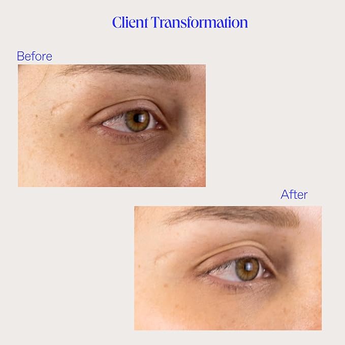 BioRepublic Lost Baggage Under Eye Emergency Repair Mask | Reduces Appearance of Lines, Bags, and Dark Circles Under Eyes | Organic Biocellulose Mask for Moisturization