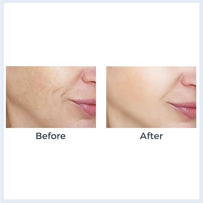 Black Pearl Collagen Mask – Hydrating & Firming