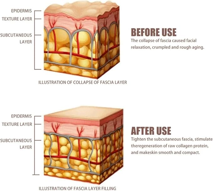 Skin Tightening Machine for Face - Anti-Aging Wrinkle Reduction for Facial Neck Lifting, Firming, Massaging and Toning Home Use 3 in 1 Upgraded Version