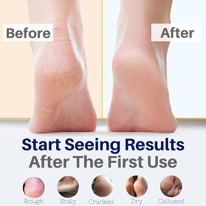 Yellow Bird Foot Cream 2 Pack Bundle - Natural Dry & Itchy Feet Repair Balm. Foot Moisturizer with Organic Ingredients and Essential Oils