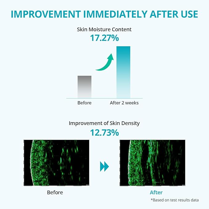 Re.SPN Bakuchiol Firming Roller Eye Cream, Niacinamide, Retinol, Adenosine, Caffeine | Self-Care, Vegan, Intense Hydration | Cream with Guasha, Glass Skin, Korean Skin Care(20ml/0.67 fl oz)