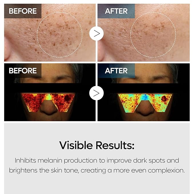 TX Tranexamic Acid Care Line TX cream+Toner+Ampoule+Cleanser Powerful Dark Spot Care | Visible Improvement in 4-8 Weeks