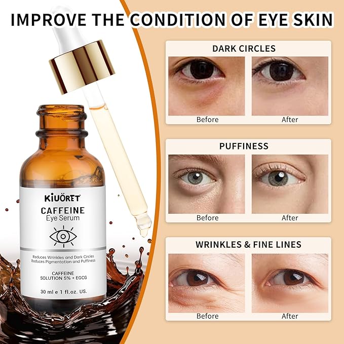 Caffeine Eye Serum with EGCG, 5% Caffeine Solution for Eyes Reduces Pigmentation and Puffiness, Under Eye Serum for Dark Circles, Wrinkles and Fine Lines for All Skin Types, 1 OZ