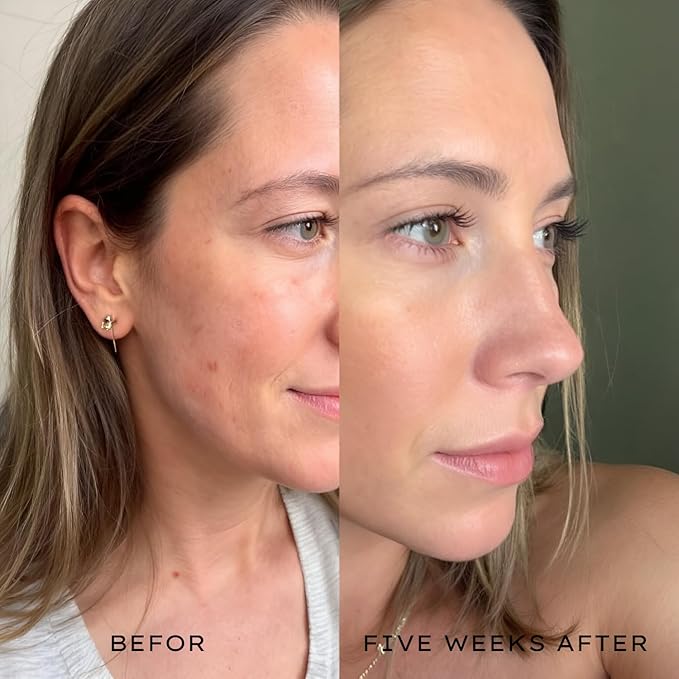 Snail Mucin 96% Power Essence, 100ml Hydrating & Repairing Facial Serum for All Skin Types, Korean Skincare Product for Hydrating, Healing No Parabens & Cruelty-Free