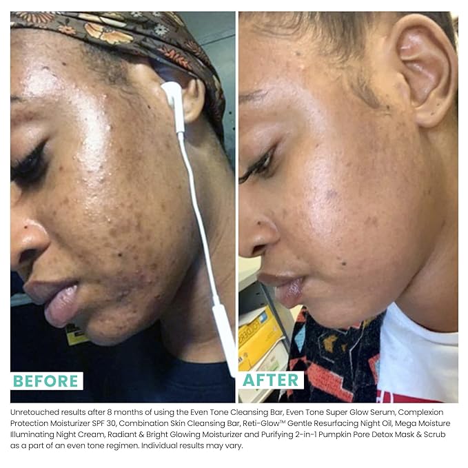 Urban Skin Rx® Mega Moisture Dry Skin Rescue Cream | Combats Signs of Aging, Helps Prevent Dry Skin and Locks In Moisture, Formulated with Vitamin E, Green Tea, & Shea Butter | 1.7 Oz