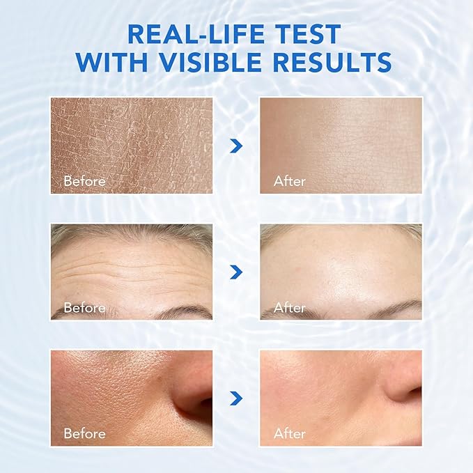 Hyaluronic Acid Serum for Face - 3% Pure Hyaluronic Acid, Hydrating Face Serum for Women & Men, Anti-Aging Skin Care for Hydration & Glow (1.2 ML x 30 PCS)