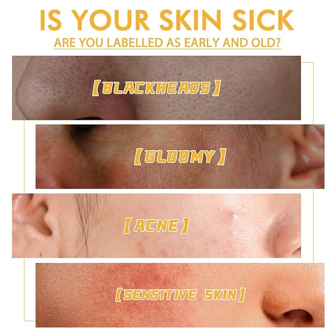 Glowtulip Honey Tearing Mask, Blackhead Control Honey Peel Mask for Face,Face Deep Cleasing & Moisturizing Mask,For All Skin (2PC)