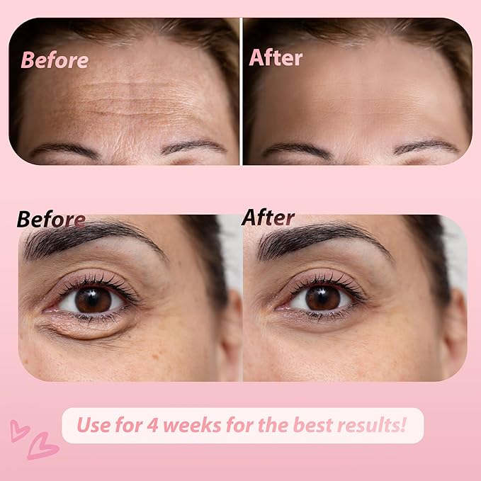 JJ&G's Forehead & Under Eye Anti Wrinkle Patches Bundle | Collagen Irish Sea Moss Vitamin C | Overnight Smoothing Treatment for Wrinkles & Fine Lines | 36 Patches