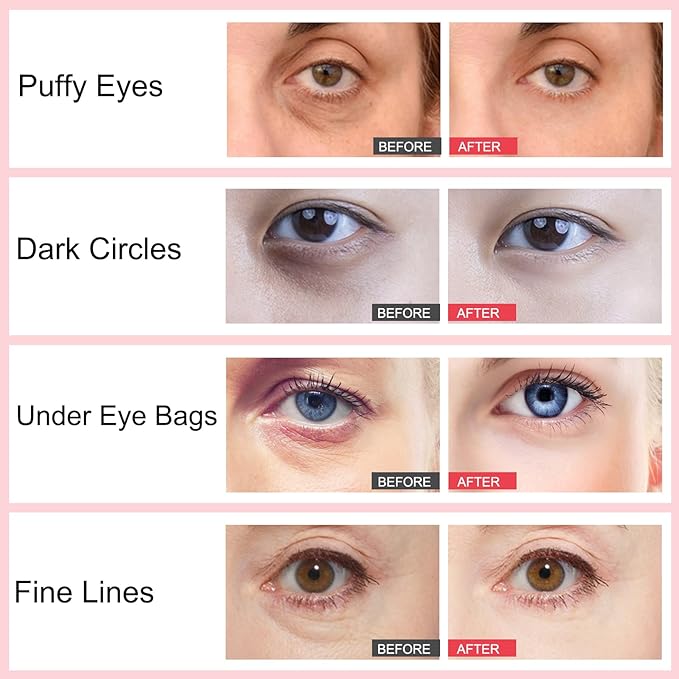 Retinol Eye Stick, Retinol Eye Cream, Under Eye Brightener Stick for Dark Circles, Eye Cream Anti Aging, Eyes Treatment Products for Fine Lines, Bags, Wrinkles, Puffiness 0.1oz(3g)