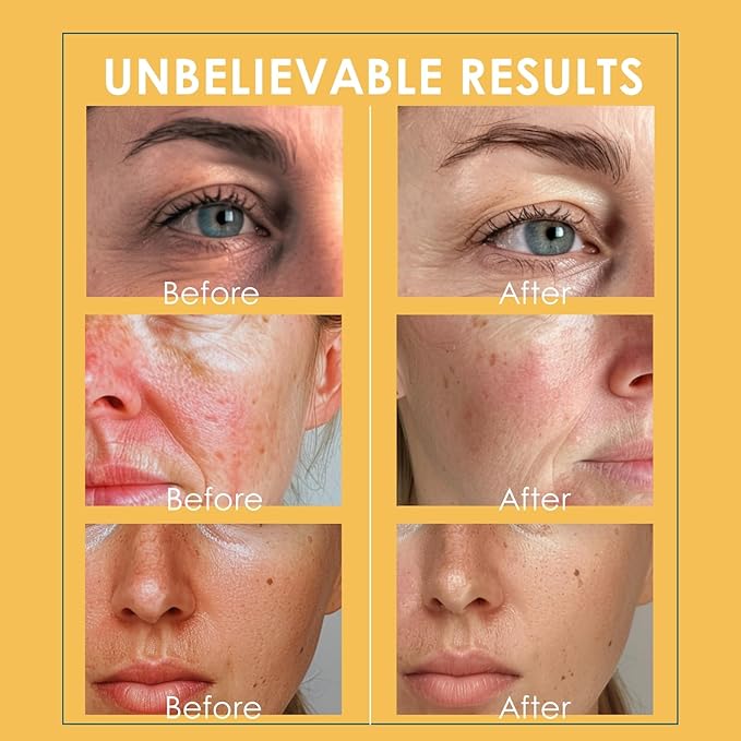 Facial Ice Globes, Cryo Cooling Massage Tool for Face, Eyes & Neck, Reduces Puffiness, Dark Circles, Fine Lines & Wrinkles, Tightens Pores, Refreshing Skincare Gift for Women & Girls, Gold