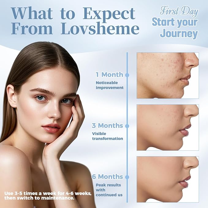 Red Light Therapy for Face – Medical-Grade LED Face Mask Light Therapy red light therapy mask for Wrinkles, Acne, and Skin Rejuvenation | Red, Blue & Infrared Light Therapy