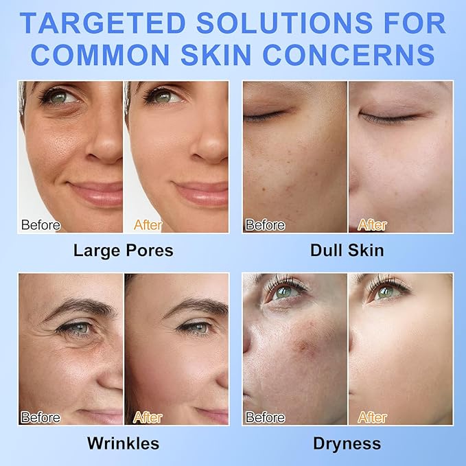 Collagen Face Mask, 6 Pack Overnight Collagen Mask for Women, Deep Collagen Anti Wrinkle Lifting Mask for All Skin Types, Pore Minimizing, Elasticity Improvement, 34g x6ea